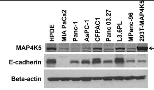 Immunoblotting for MAP4K5 and E-cadherin expression in HPDE cells.jpg